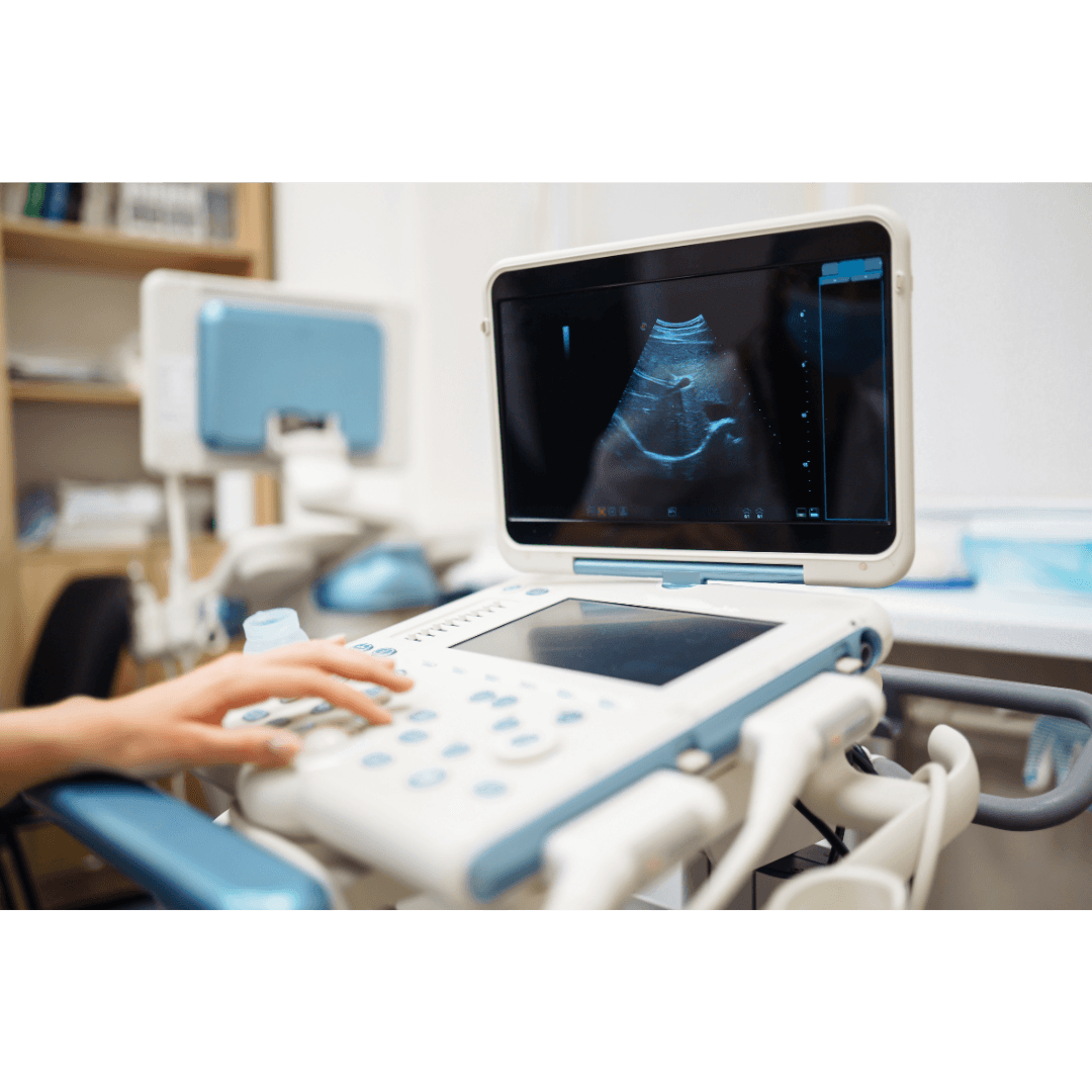 Ultrasound Scan